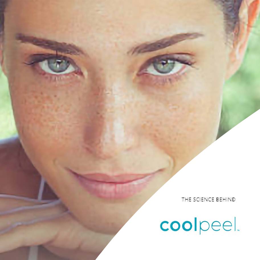 Coolpeel-SmartXide-Punto-Dekalaser