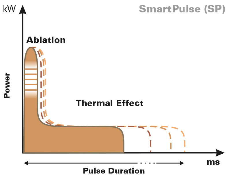 SmartPulse-fractional-laser-pulse-shapes-Punto