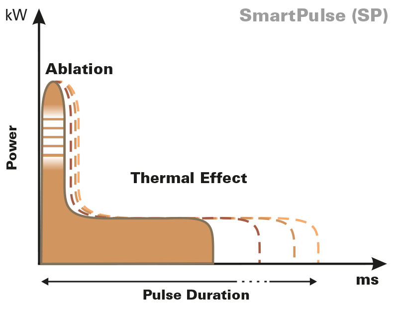SmartPulse-fractional-laser-pulse-shapes