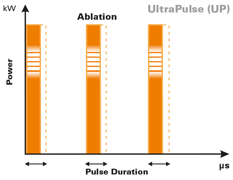 UltraPulse-fractional-laser-pulse-shapes